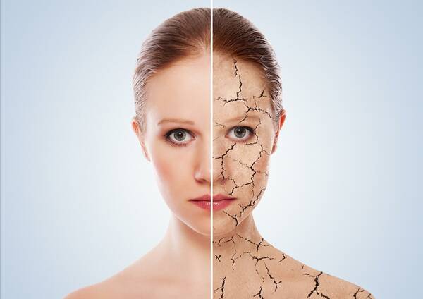 Micro-Needling